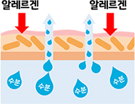 아토피 피부염 피부장벽의 이상